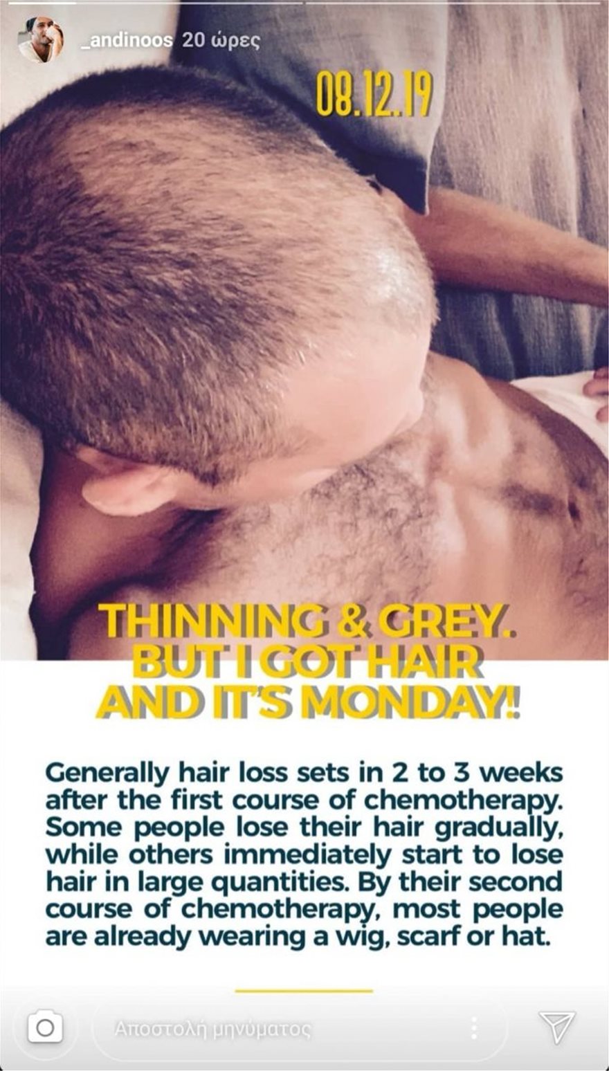 Αντίνοος Αλμπάνης