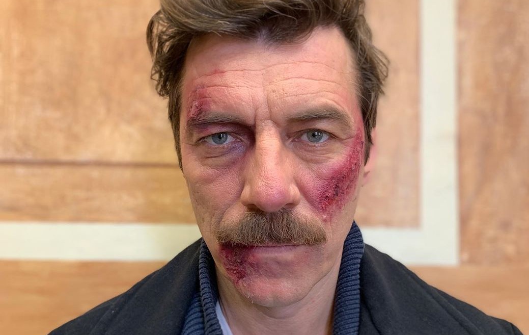 Στάνκογλου