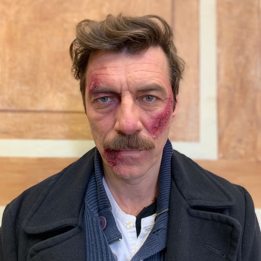 Στάνκογλου