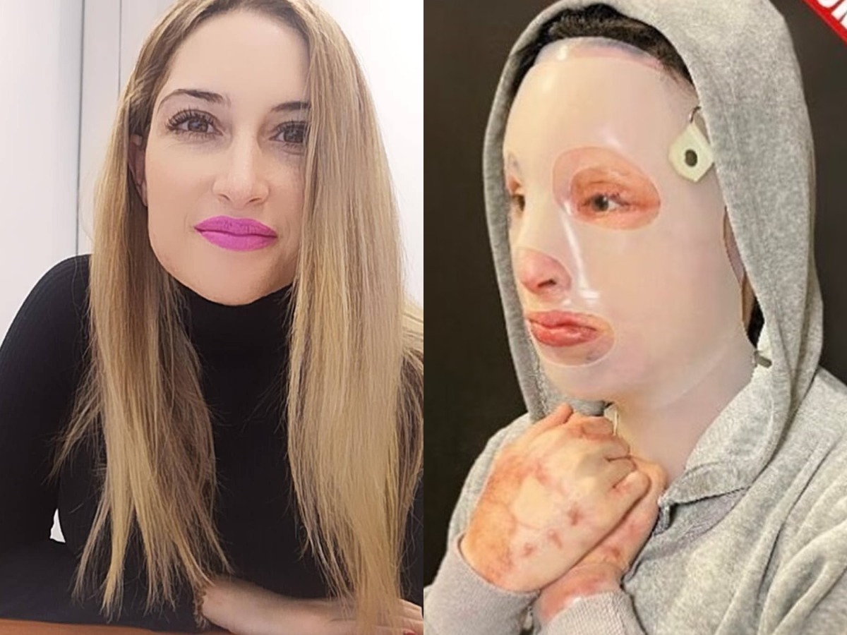 Εισαγγελέας: Απόπειρα ανθρωποκτονίας η επίθεση με βιτριόλι