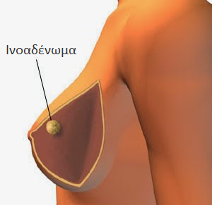 niotis-1620226165-19