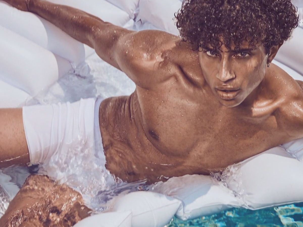 GNTM - Ηρακλής Τσουζίνοβ: Οι πρώτες φωτογραφίες μετά τον τραυματισμό του