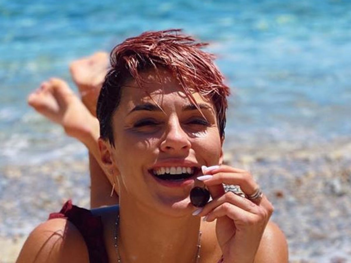 Κάτια Ταραμπάνκο: μίλησε ανοιχτά για το πρόβλημα που έχει με την ψωρίαση