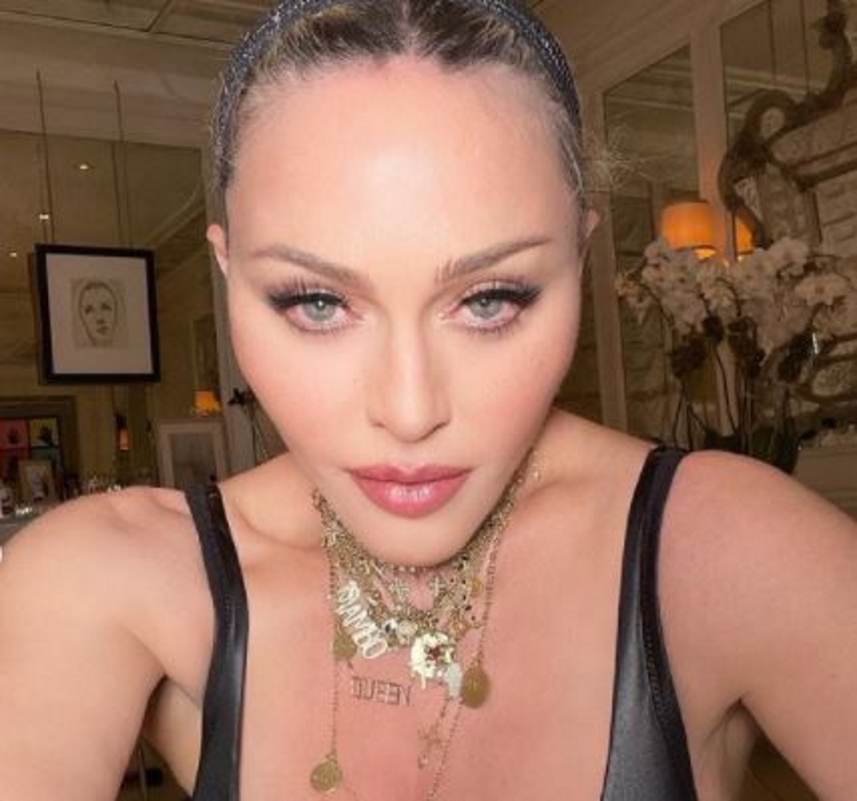 Μαντόνα: Έτσι θα ήταν η βασίλισσα της pop χωρίς τις πλαστικές επεμβάσεις