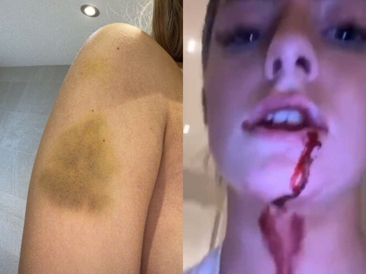 ΣΟΚ! Πασίγνωστος ποδοσφαιριστής κατηγορείται για τον ξυλοδαρμό της συντρόφου του