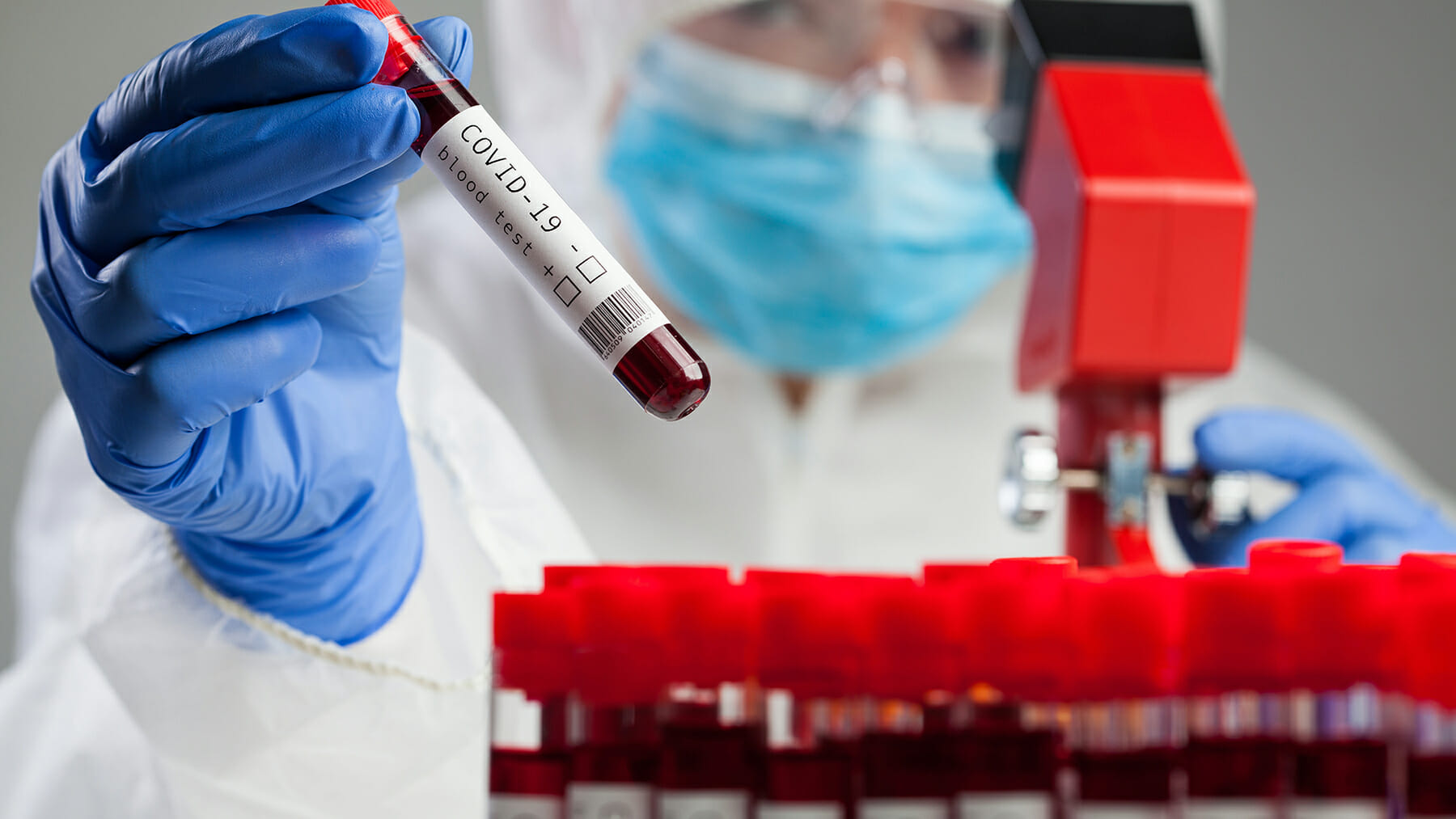 Κορονοϊός: το μονοκλωνικό αντίσωμα που δρα σε όλες τις παραλλαγές της μετάλλαξης Omicron