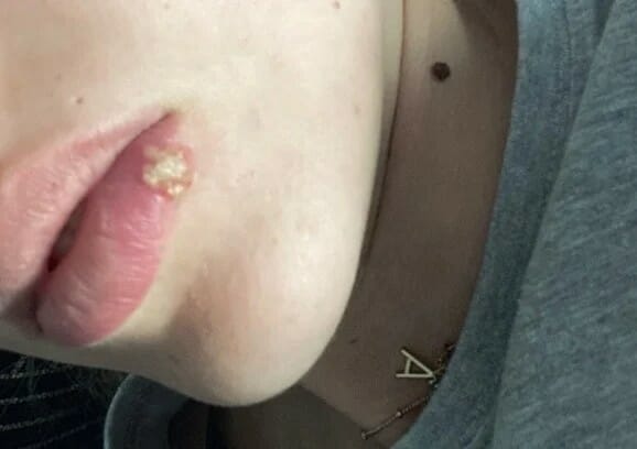 Άννα Κορακάκη