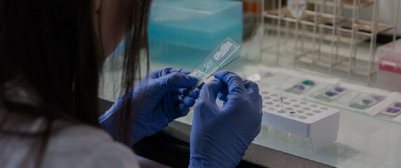 Κορονοϊός: το κοινό σύμπτωμα όσων νόσησαν βαριά - Τι δείχνει νέα έρευνα