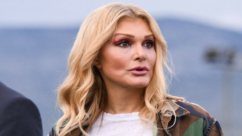 Η Νατάσα Θεοδωρίδου μιλά για το κεφάλαιο «πλαστικές επεμβάσεις»