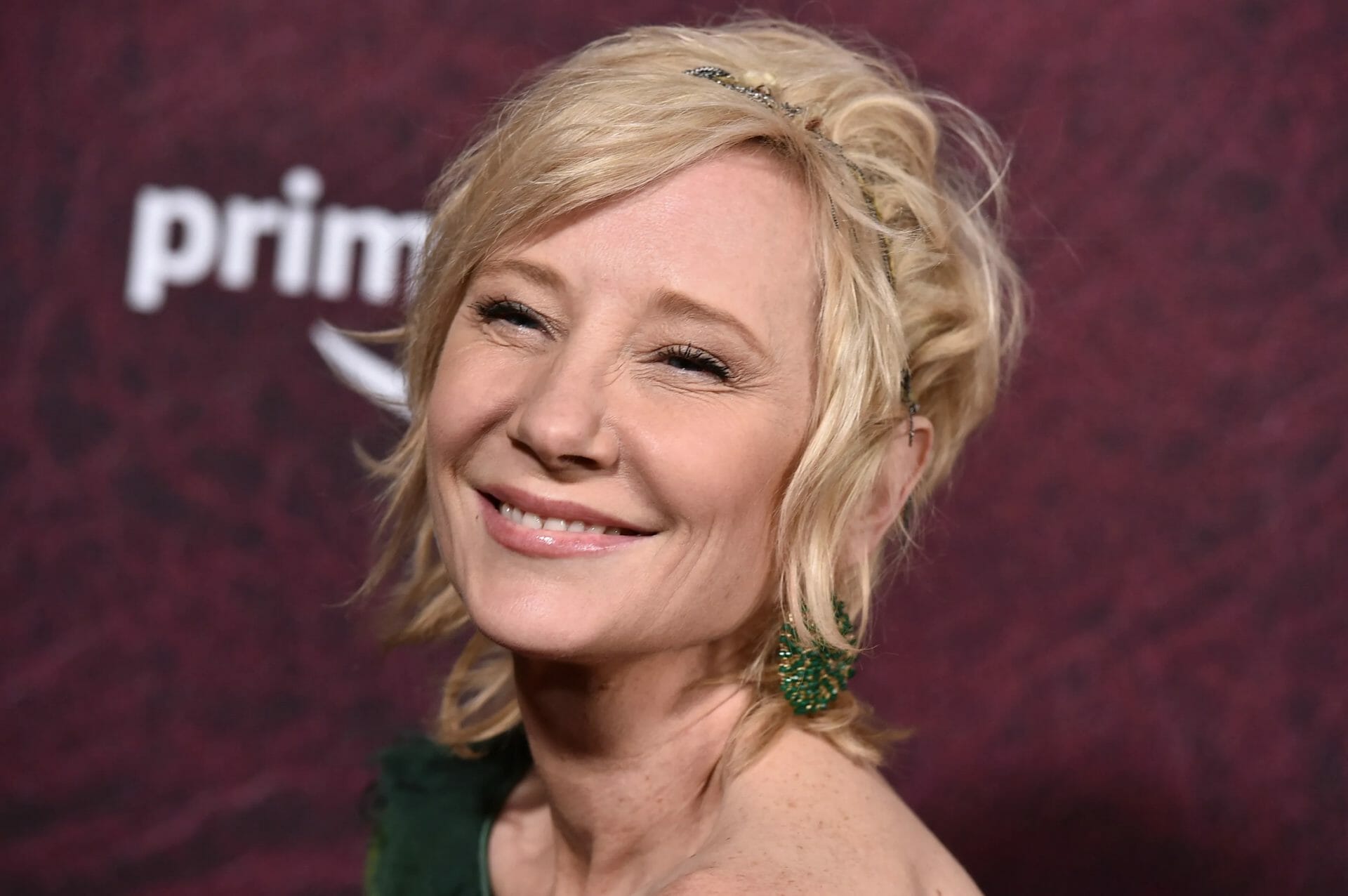 Anne Heche: Όσα έδειξε η ιατροδικαστική έκθεση για τα αίτια θανάτου της