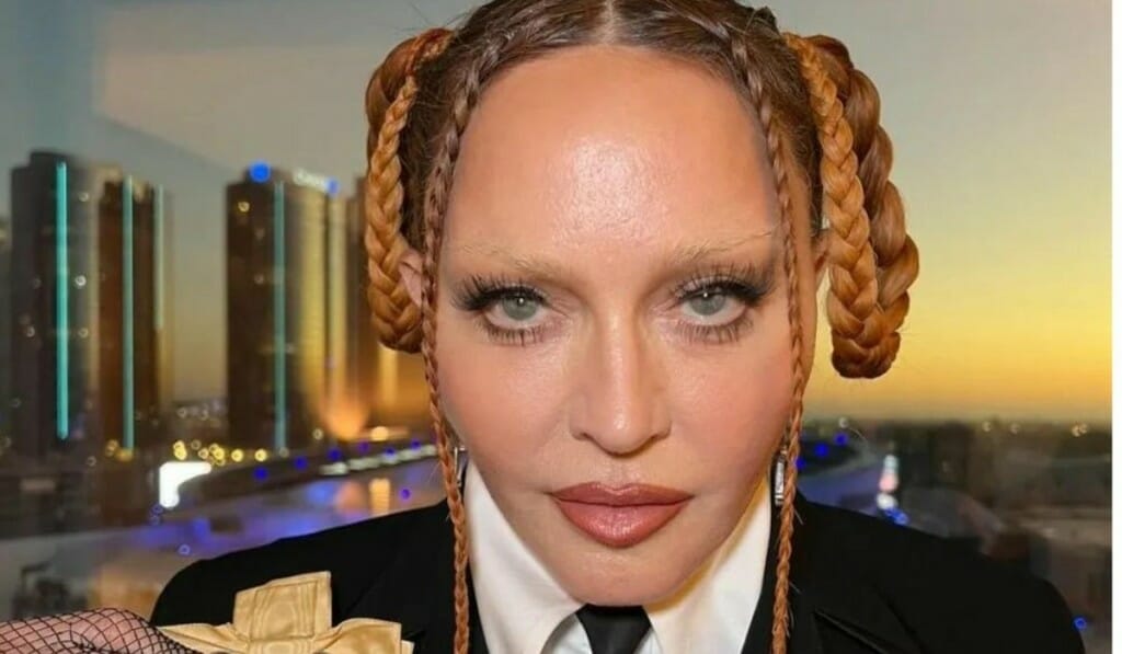 Μαντόνα: Απαντά στους επικριτές της για τις πλαστικές - «Υποκλιθείτε σκύλες»