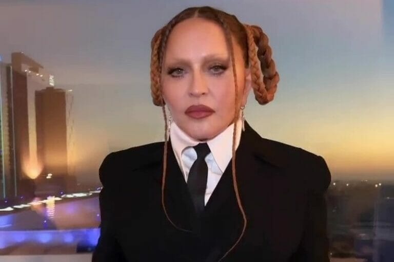 Μαντόνα: Πλαστικός εξηγεί τι έχει κάνει η βασίλισσα της ποπ και έχει παραμορφωθεί