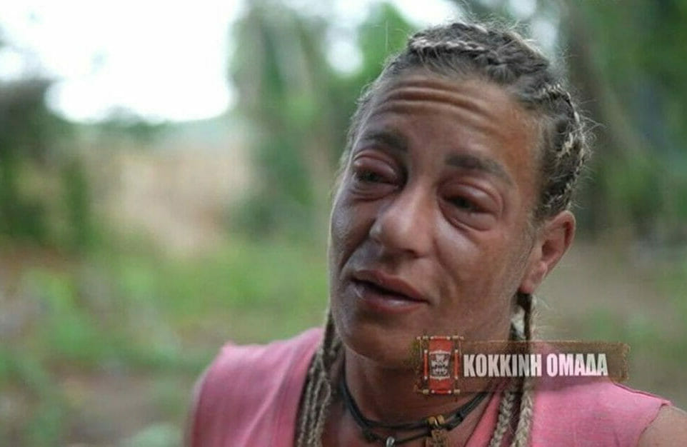 Survivor All Star: Το αλλεργικό σοκ της Αφροδίτης Σκαφίδα που παραμόρφωσε το πρόσωπό της